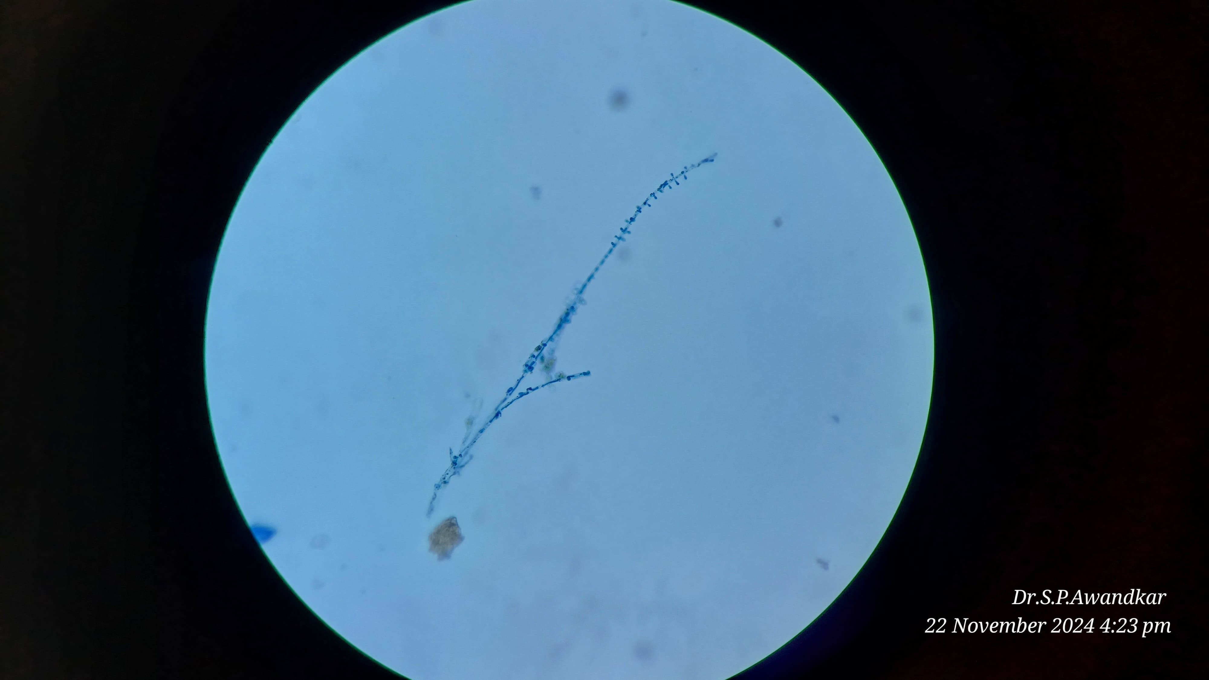 29. Microsporum Nanum